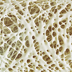 Pohľad pod mikroskopom na normálnu štruktúru kosti.
